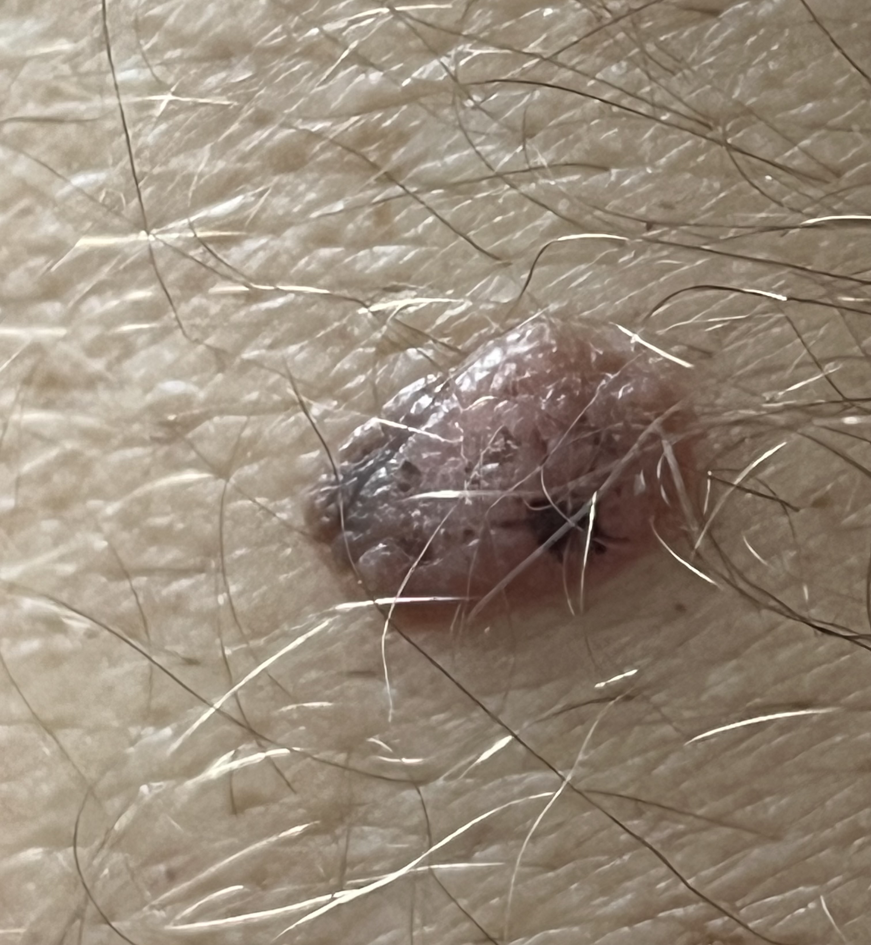 Znaménko obrázek 1