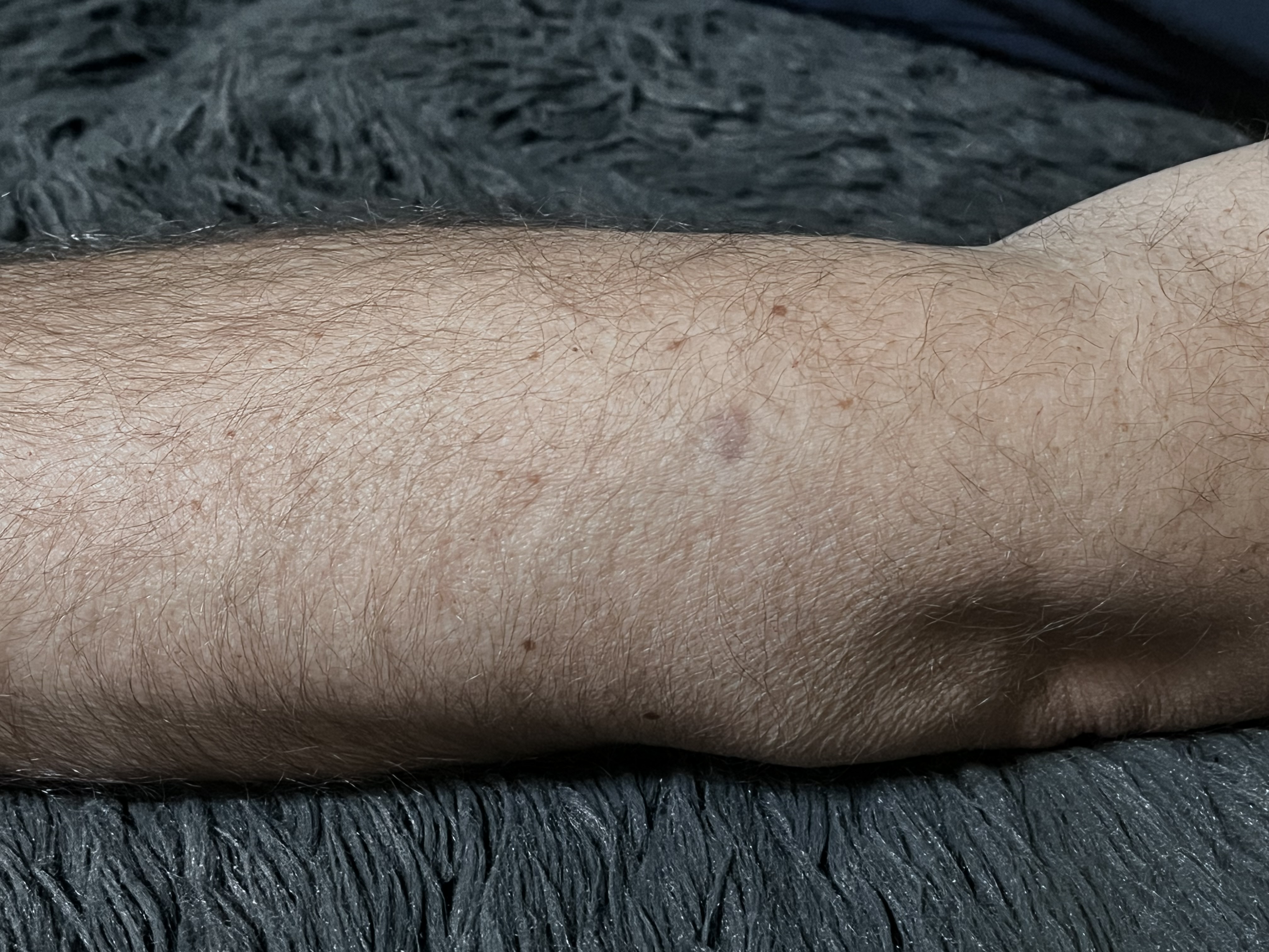 Aktuální stav znamínka, obrázek 5