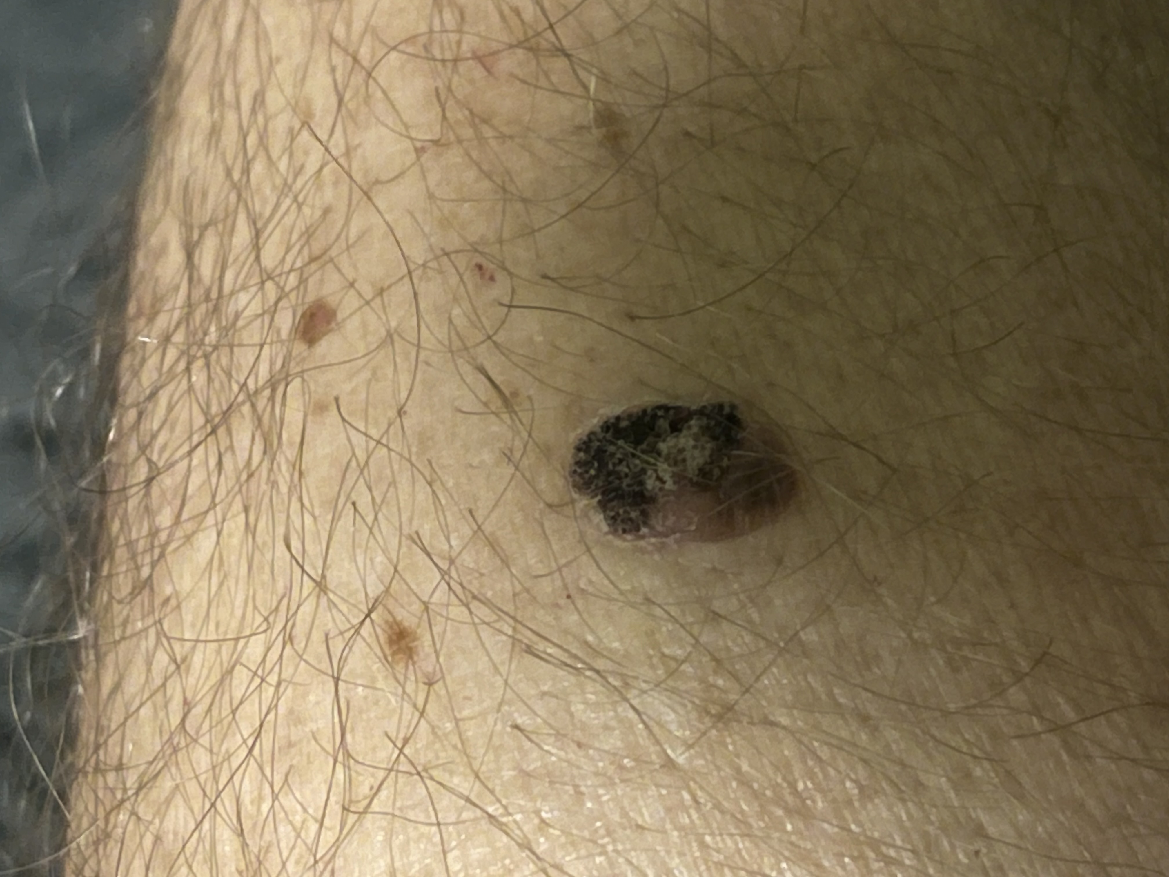 Znamínko obrázek 3