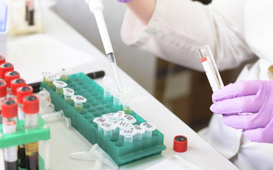 Laboratorní testy, zdroj obrázku Pixabay.com