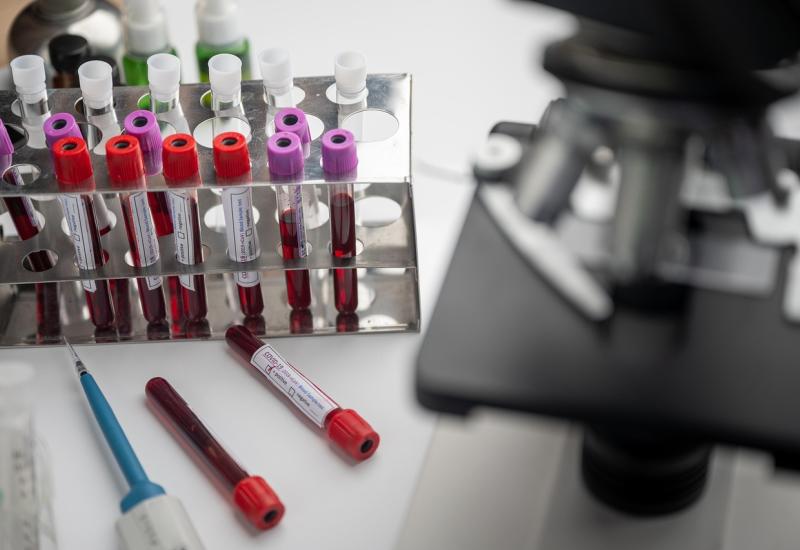 Laboratorní rozbory lidské krve, zdroj obrázku Pixbay.com