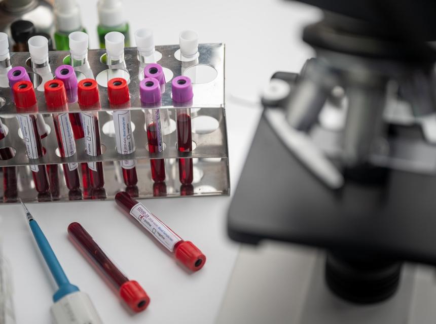 Laboratorní rozbory lidské krve, zdroj obrázku Pixbay.com